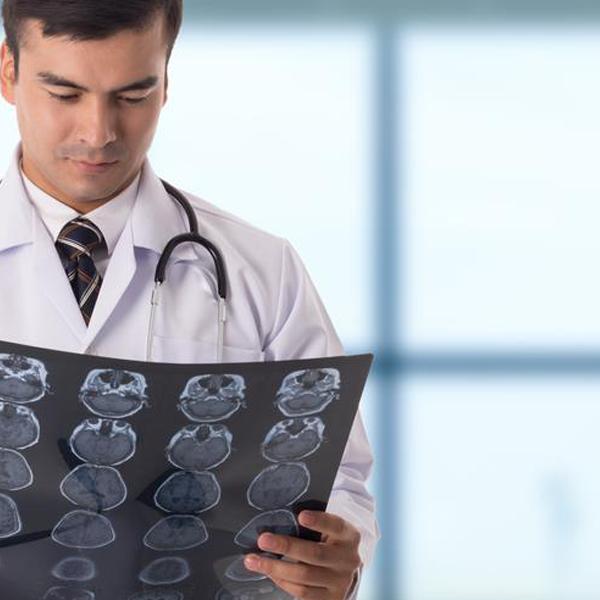 Patologie neurologiche